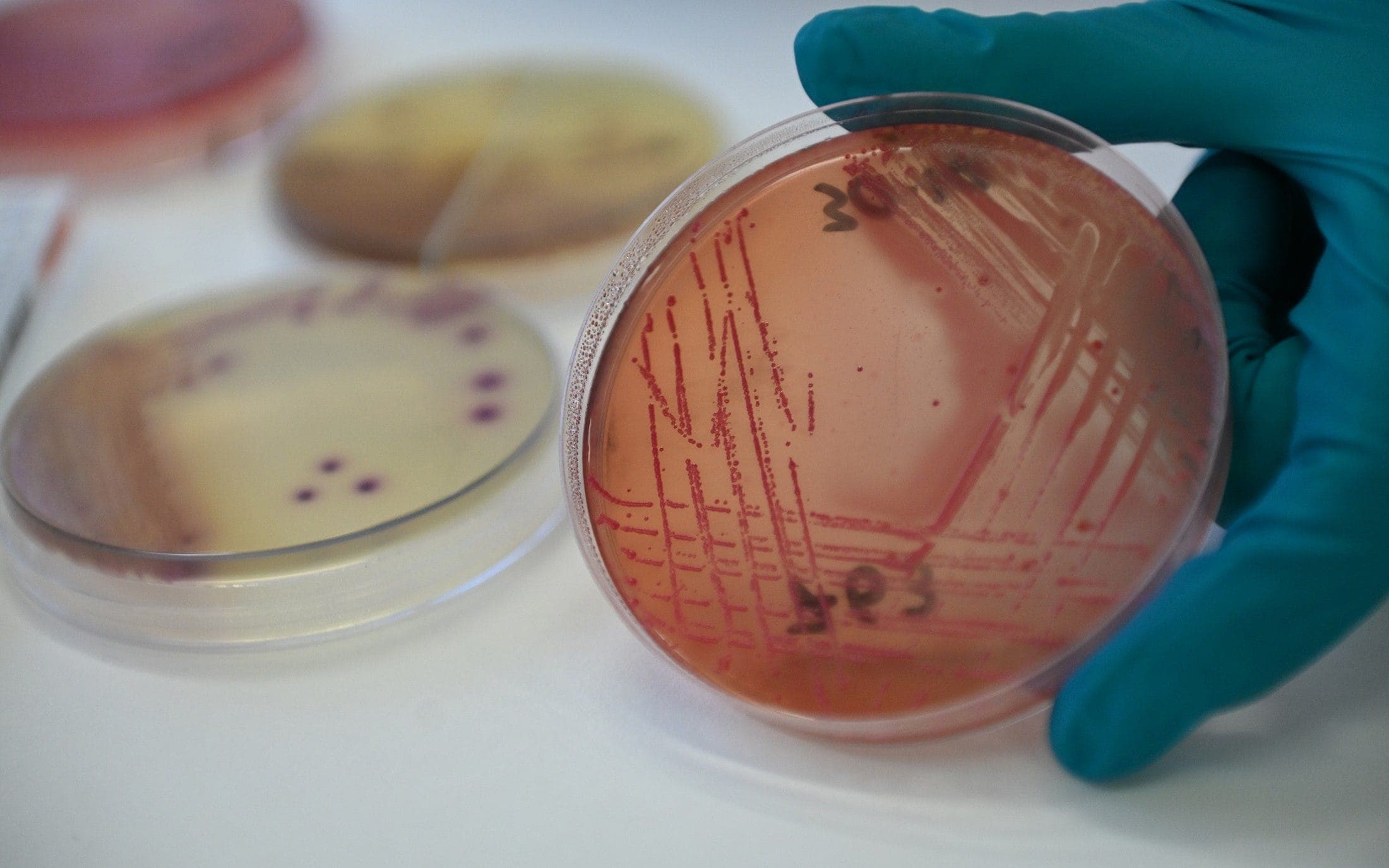Fightback: scientists score series of wins in battle against superbugs